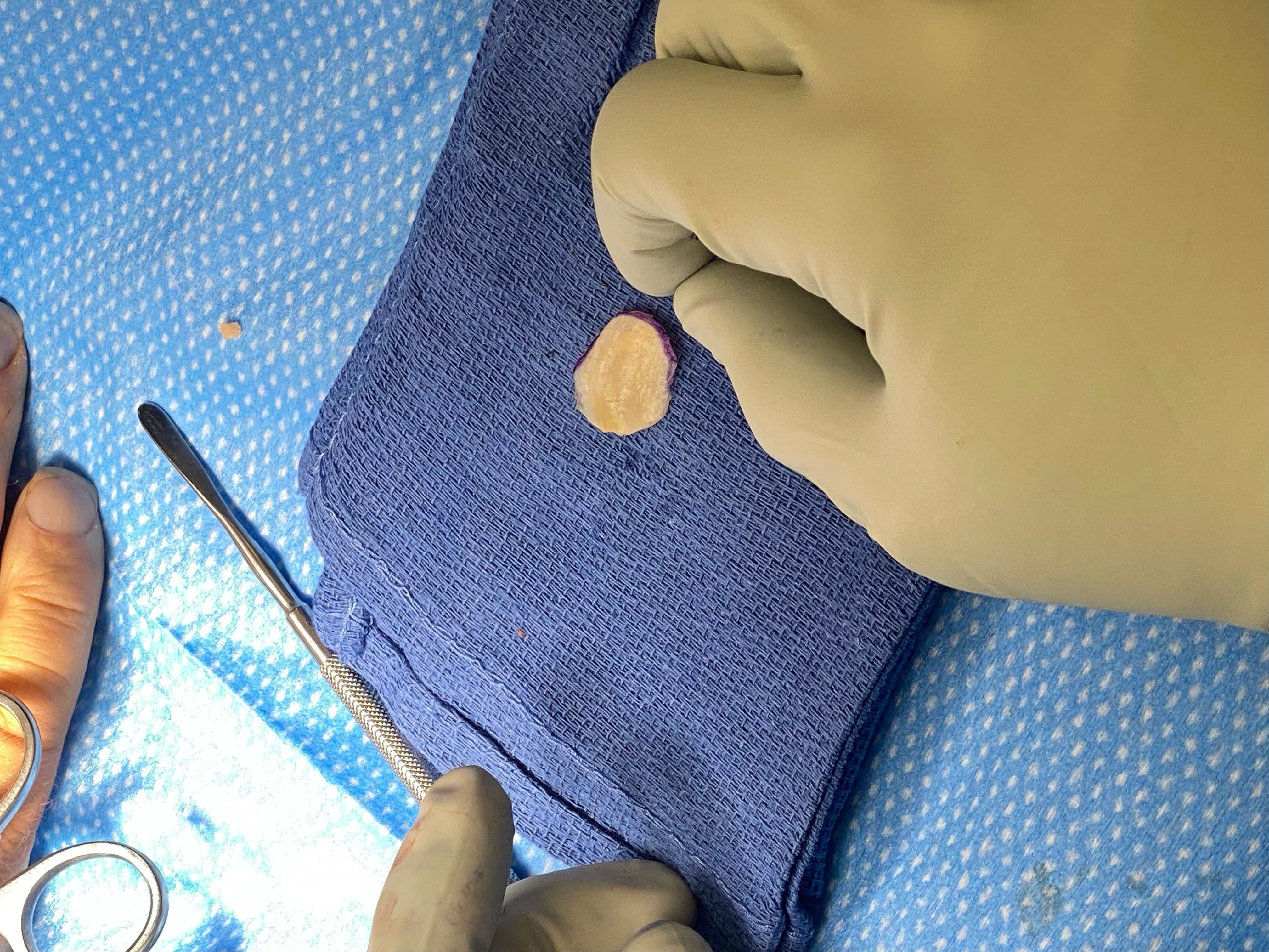 Graft preparation on the sterile surgical field