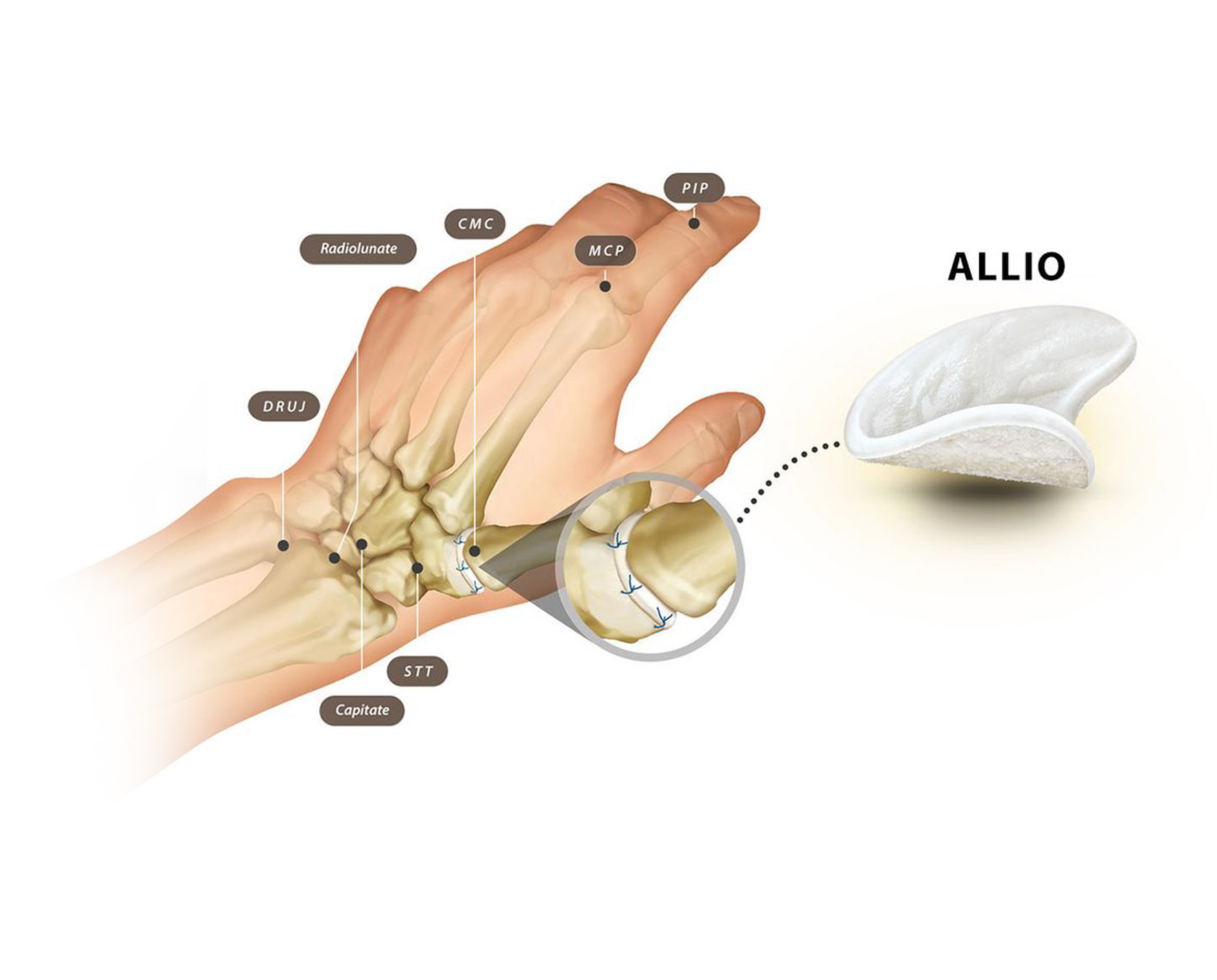 ALLIO product