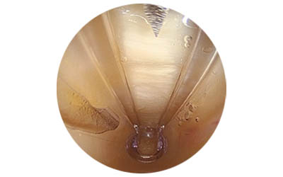 STRATOS clear cannula placeholder