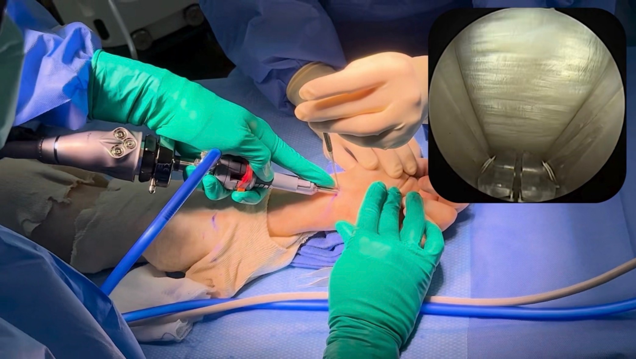 Hands-on endoscopic surgical training with an inset scope view